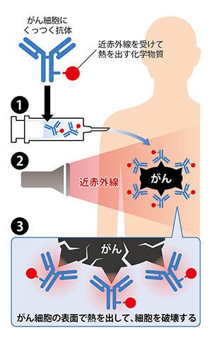近赤外線を使った新しいがん治療法のイメージ