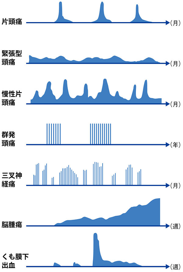 『「片頭痛」からの卒業』（講談社現代新書）