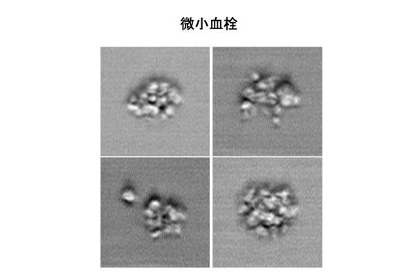 写真2：微小血栓をセレンディピターで撮影